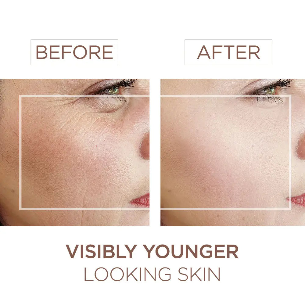 Anti-Aging Face Cream with Bee Venom + Royal Jelly